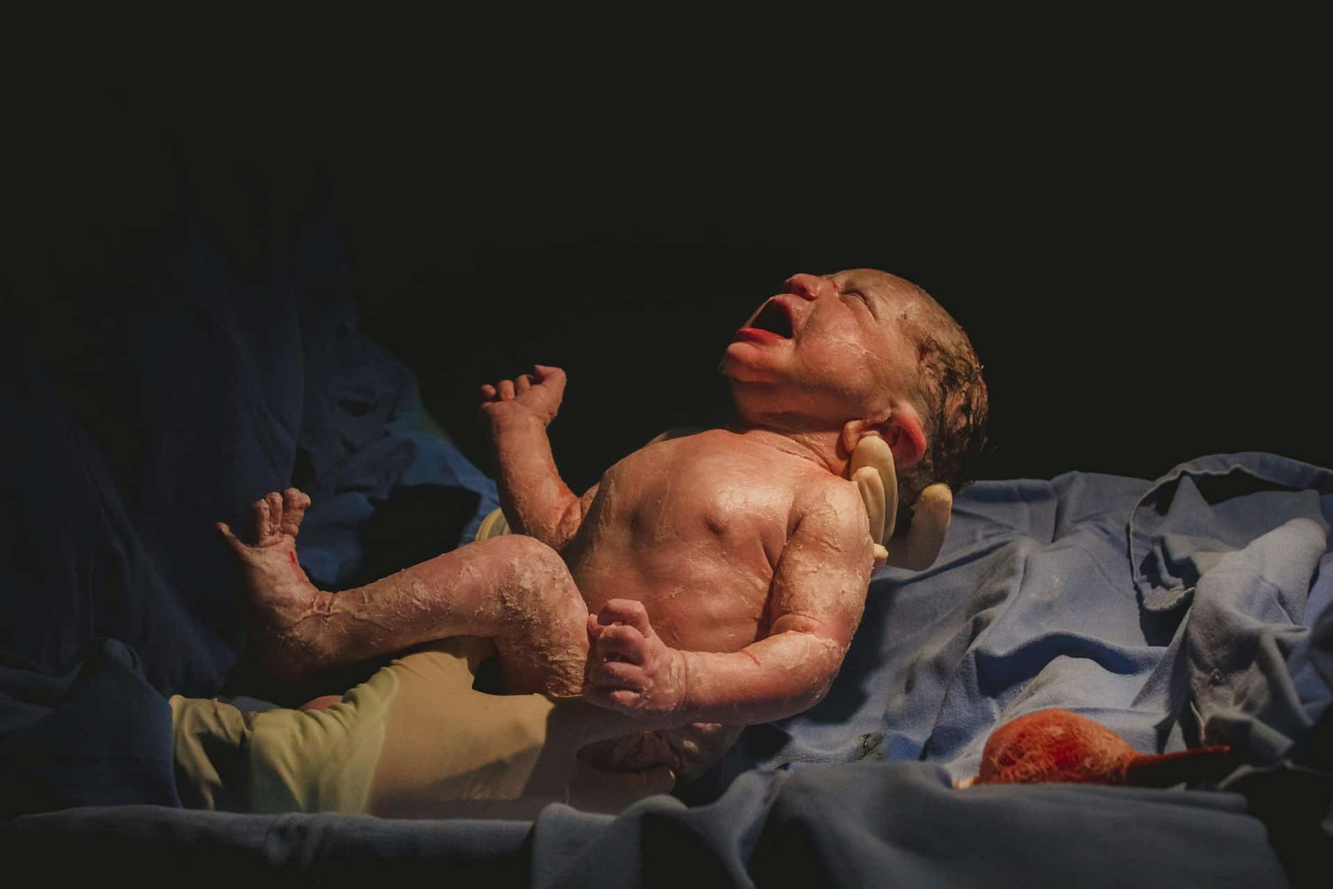Birth Trauma
